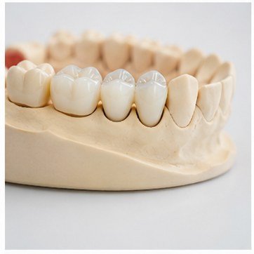 Dental crowns and restorations