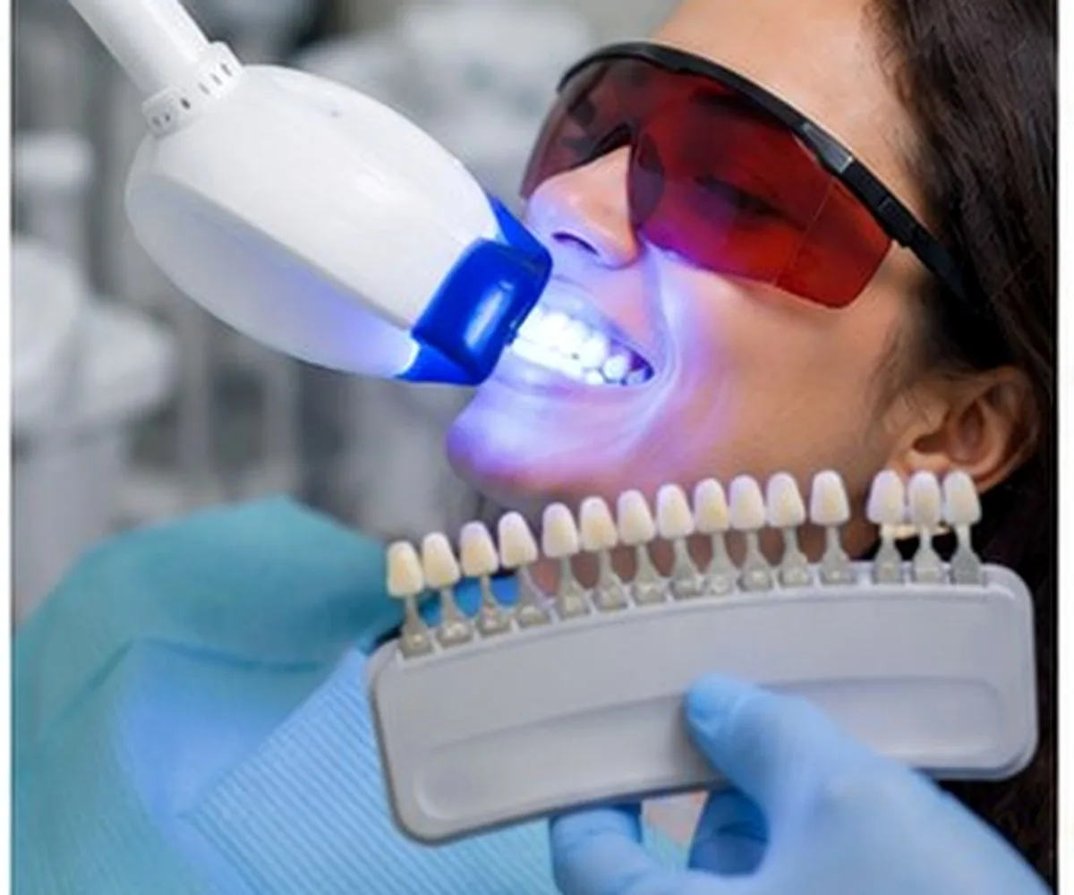 Teeth Whitening Pune dental care at Amayra Polyclinic & Dental Hub